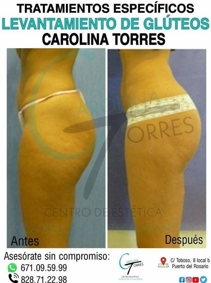 Images Centro De Estetica Carolina Torres