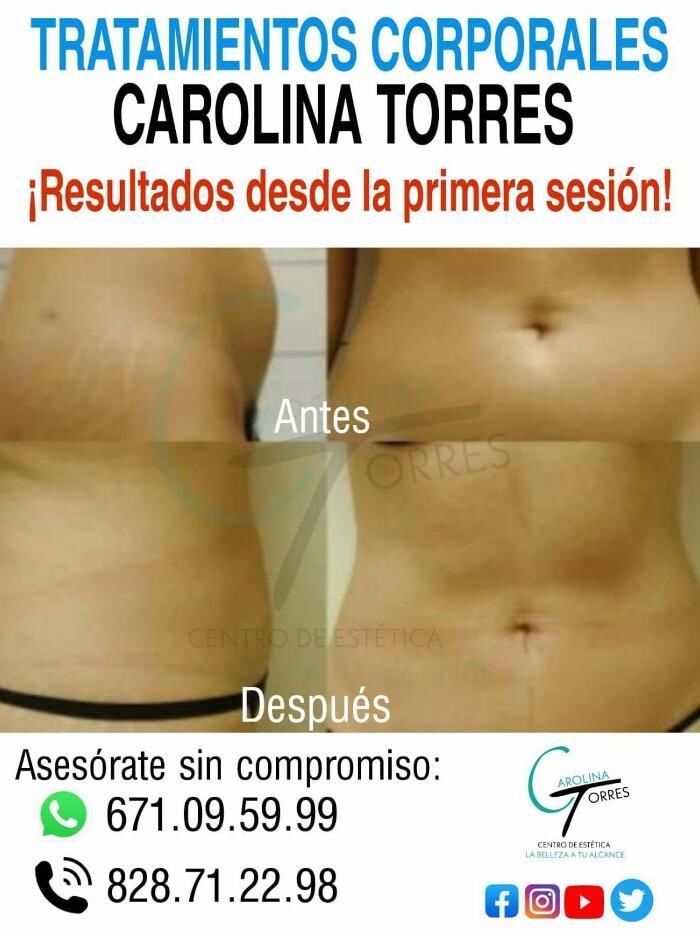 Images Centro De Estetica Carolina Torres
