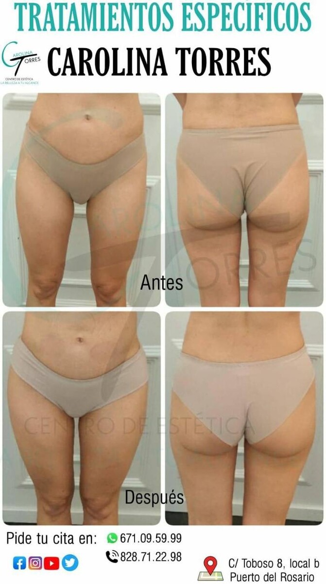 Images Centro De Estetica Carolina Torres