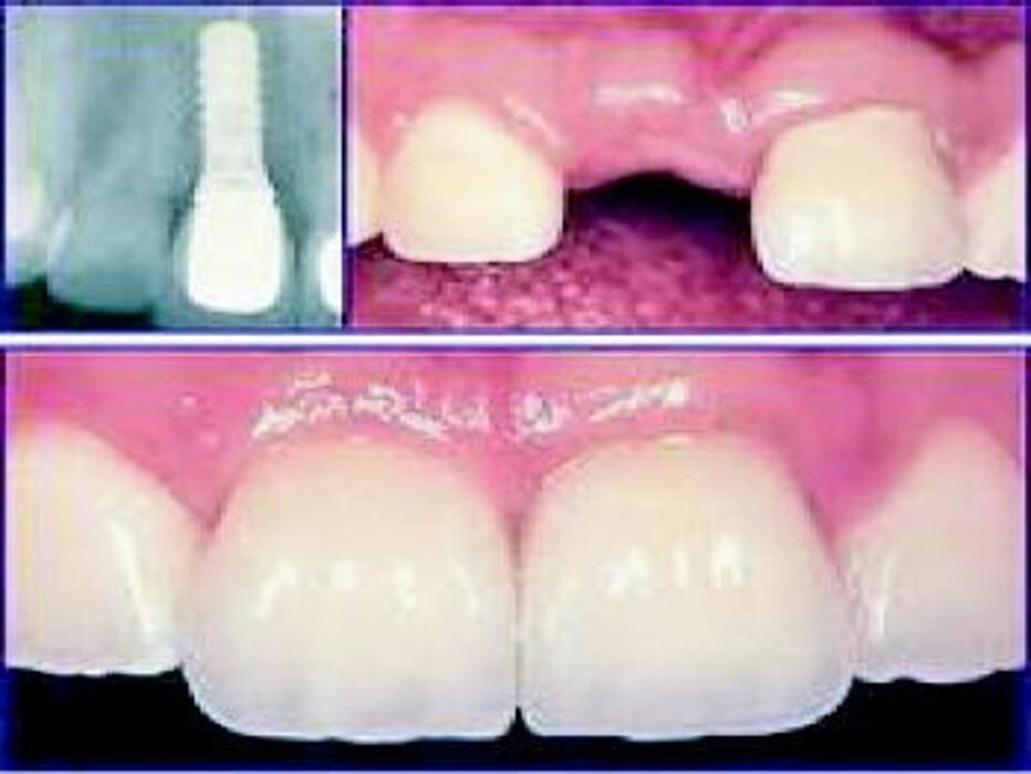 Images Clinica Dental Dr. Samuel Cumplido Santiago