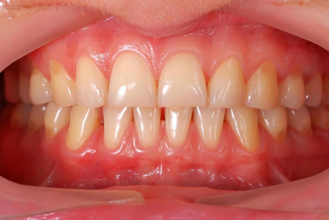 Images Clínica Dental Santa Eulàlia