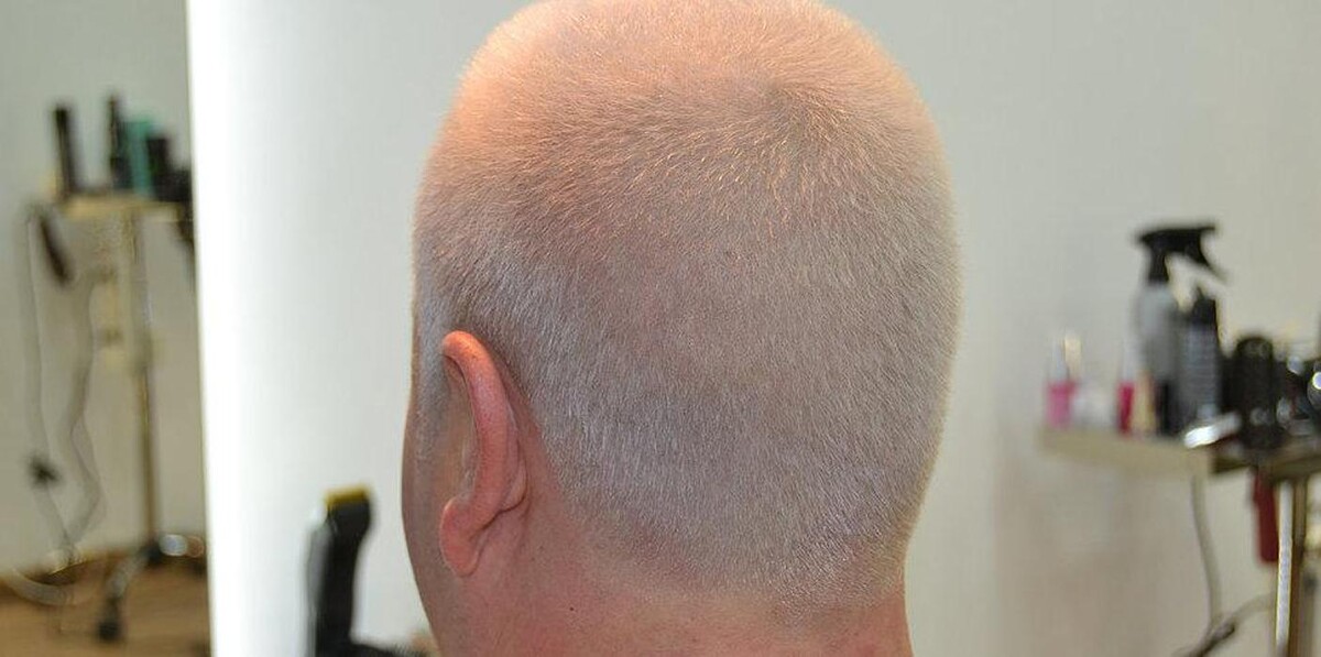 Images The Men's Hair Club