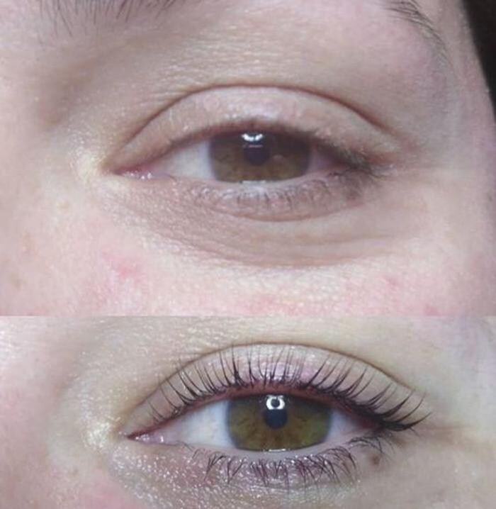 Images Laura Roussel Estética