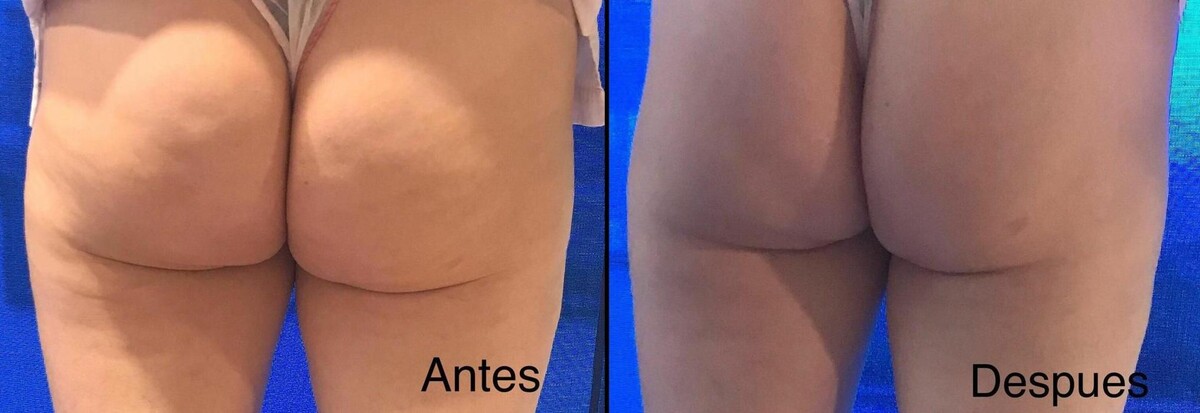 Images DRA. ADRIANA ANTESOLA