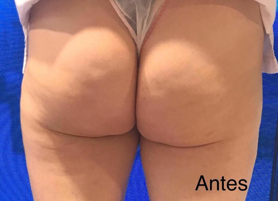 Images DRA. ADRIANA ANTESOLA