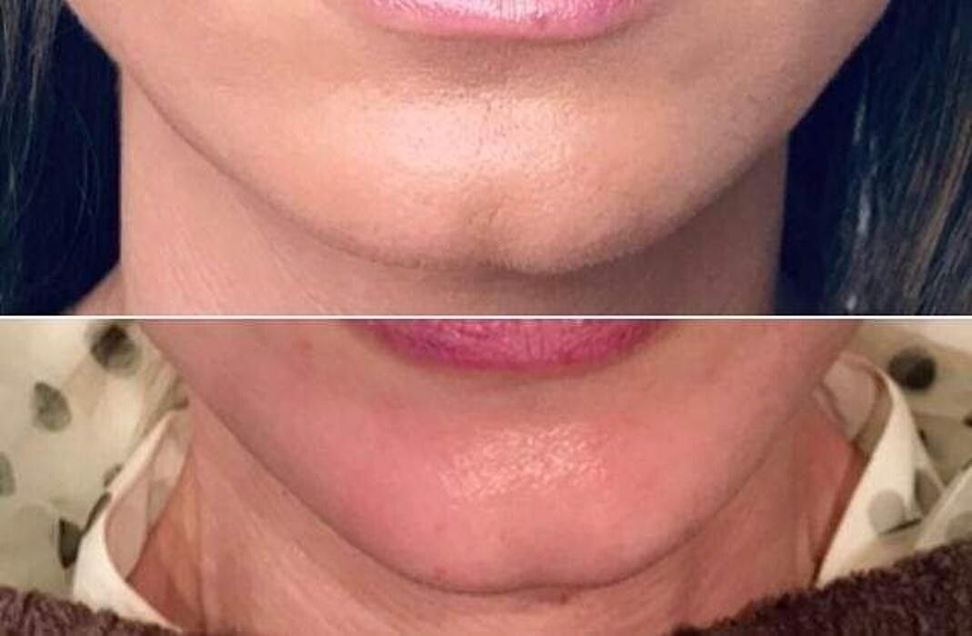 Images DRA. ADRIANA ANTESOLA