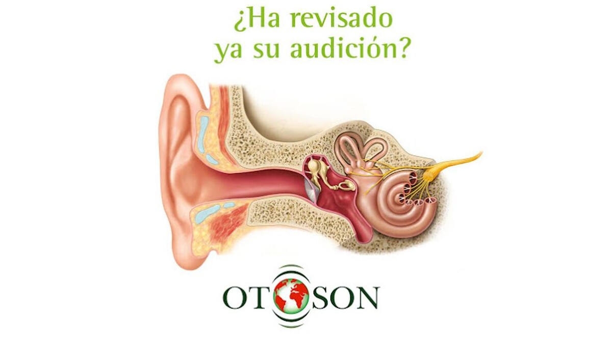 Images Centro auditivo Otosón