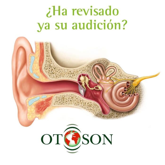 Images Centro auditivo Otosón