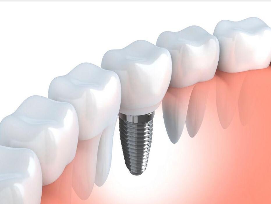 Images Clínica D'Odontología Avançada Nature Dental