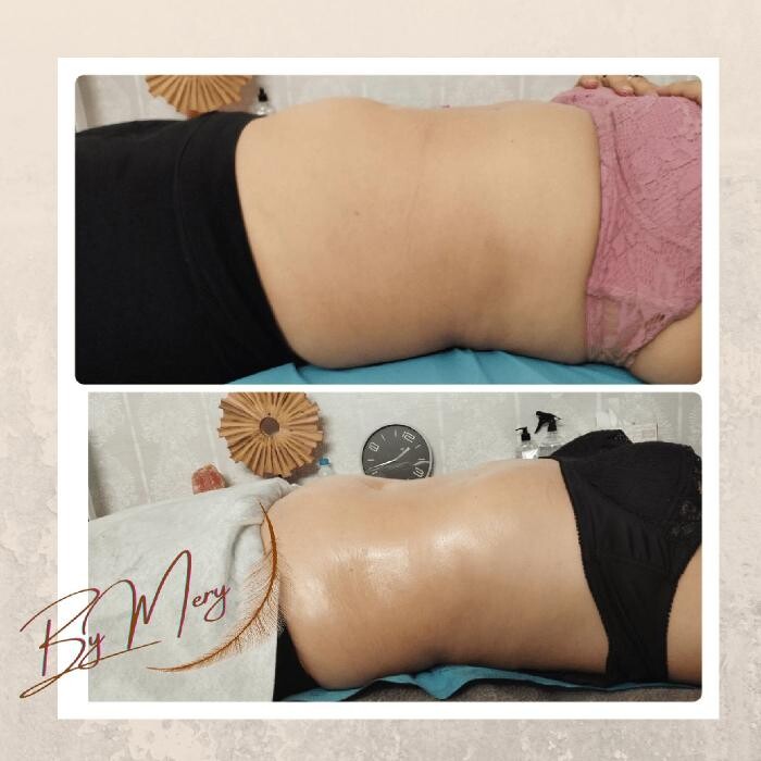 Images MERY TERAPIAS NATURALES