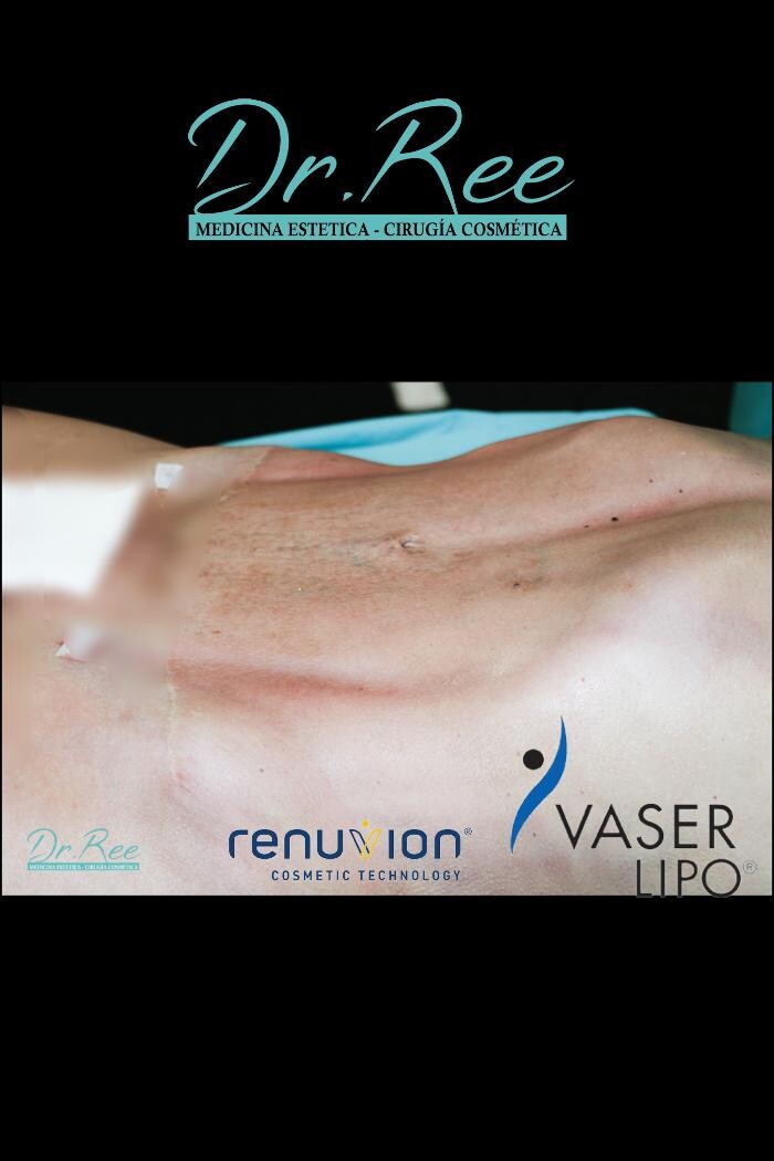 Images DR REE BCN