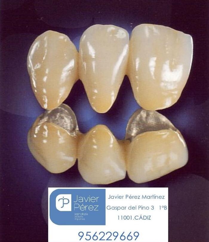 Images Clínica Dental Dr. Javier Pérez Martínez