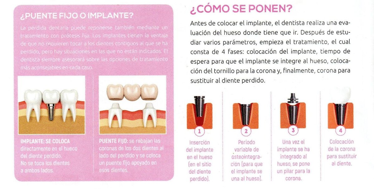 Images Clínica Dental Dr. Javier Pérez Martínez