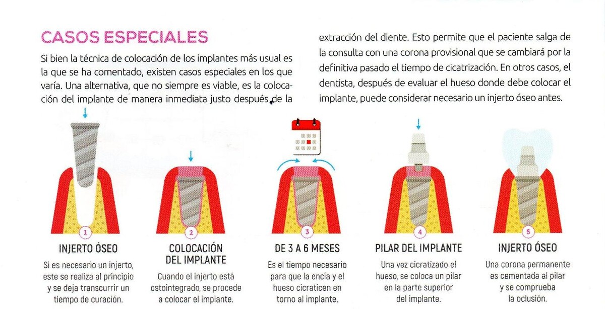 Images Clínica Dental Dr. Javier Pérez Martínez