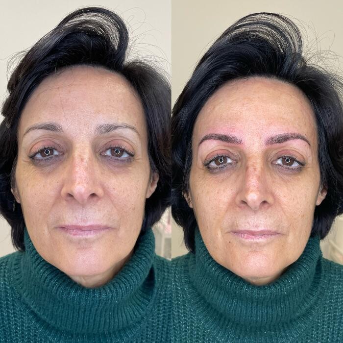 Images Marga Beltrán estética avanzada y micropigmentación