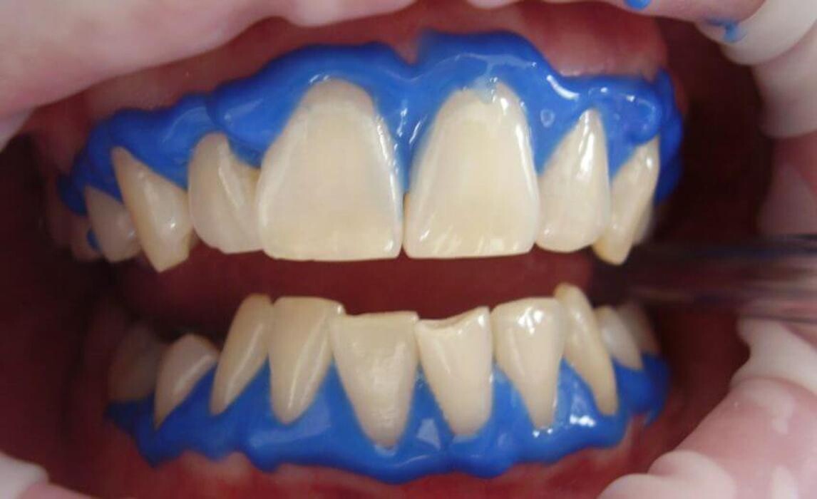 Images MOLINA CLÍNICA DENTAL
