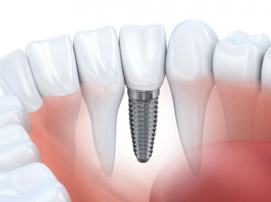 Images MOLINA CLÍNICA DENTAL