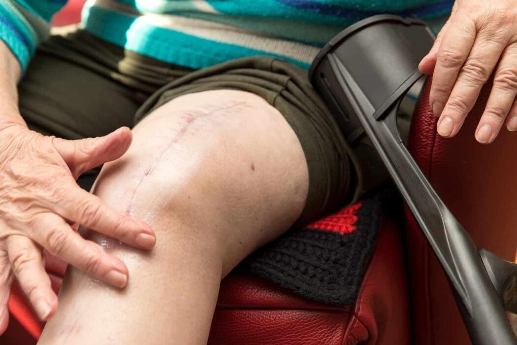 Images PILLAO QUESADA, J.