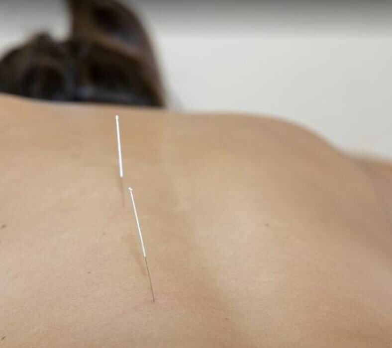 Images Centro de Fisioterapia Rehab Esport