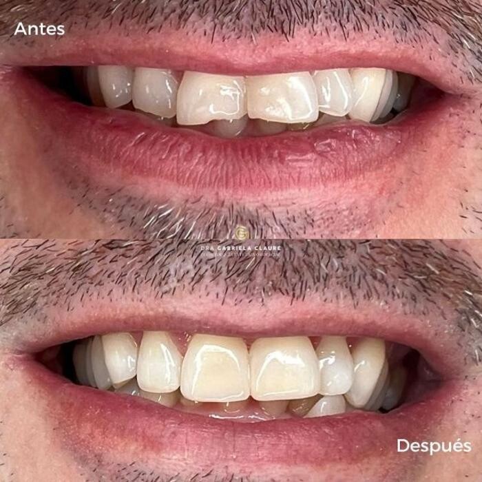 Images Dra. Gabriela Claure - Odontología Estética