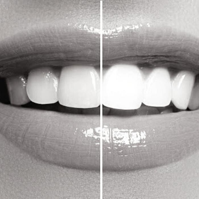Images Dra. Gabriela Claure - Odontología Estética