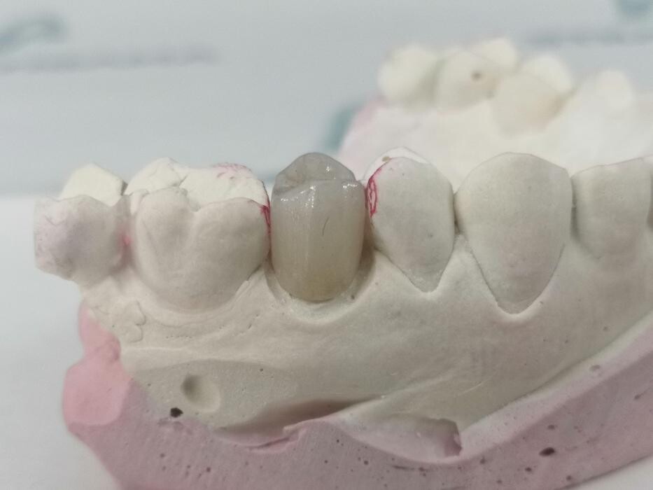 Images Laboratorio Dental Anabitarte