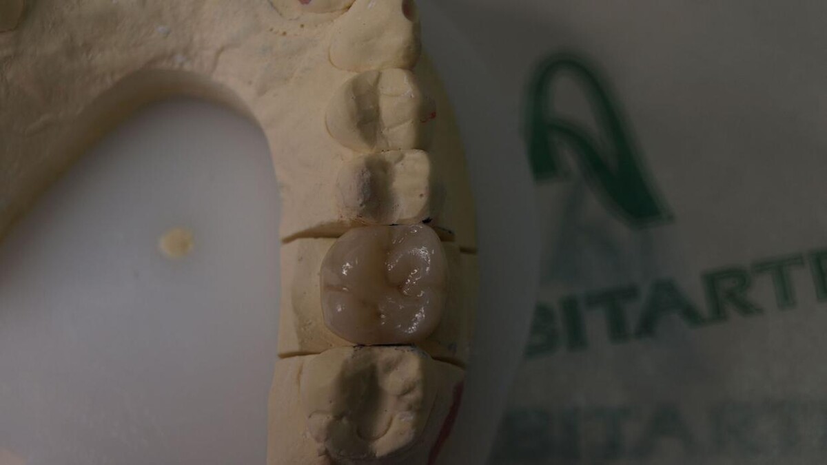 Images Laboratorio Dental Anabitarte