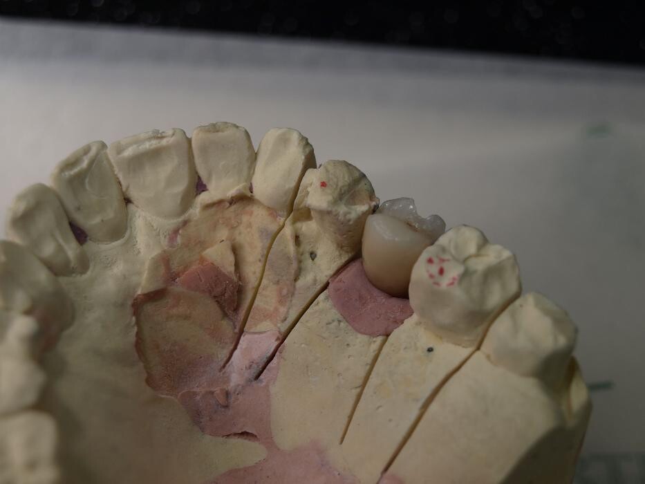 Images Laboratorio Dental Anabitarte