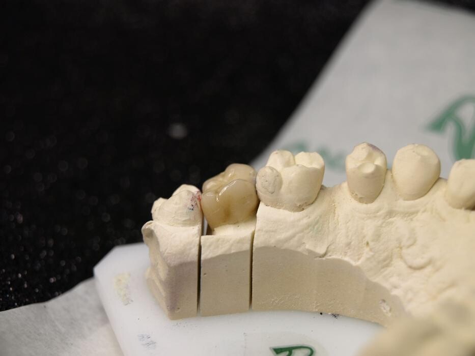 Images Laboratorio Dental Anabitarte