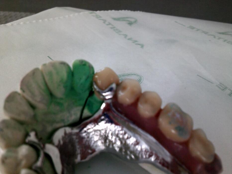 Images Laboratorio Dental Anabitarte