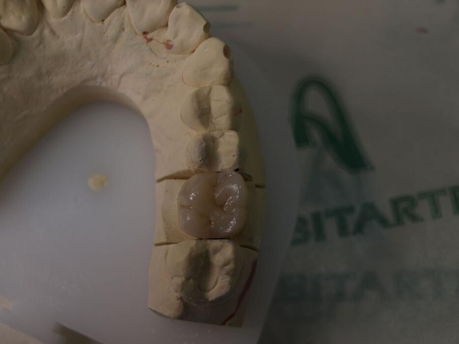 Images Laboratorio Dental Anabitarte