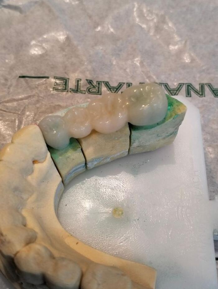 Images Laboratorio Dental Anabitarte
