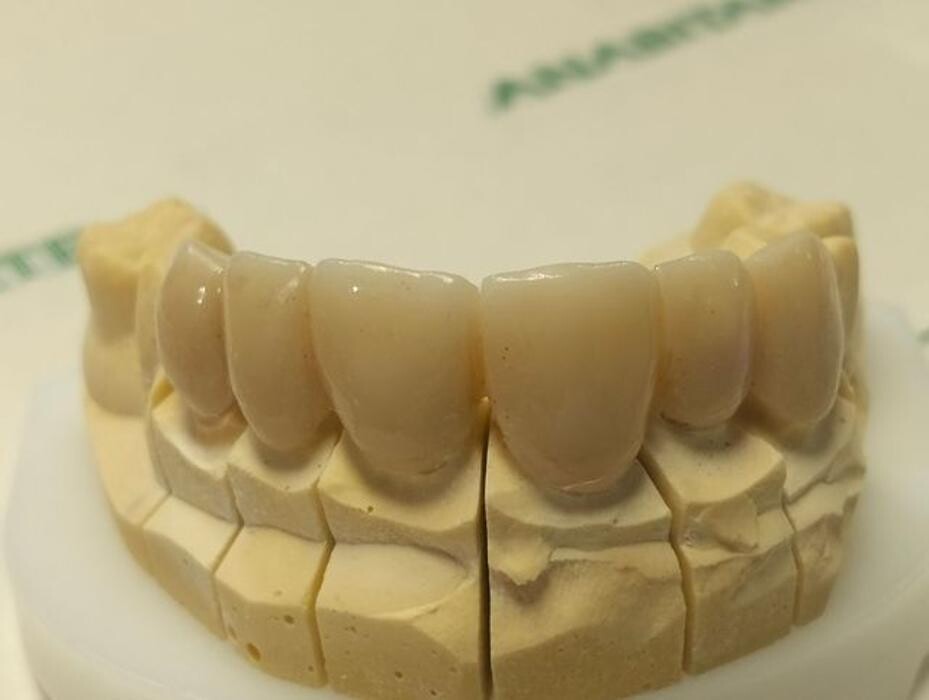 Images Laboratorio Dental Anabitarte