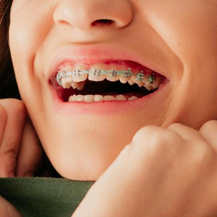 Images Lepanto Clínica Dental