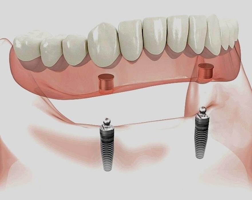 Images Lepanto Clínica Dental