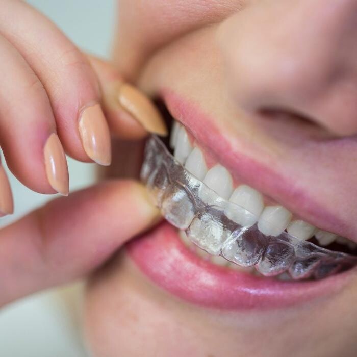 Images Lepanto Clínica Dental