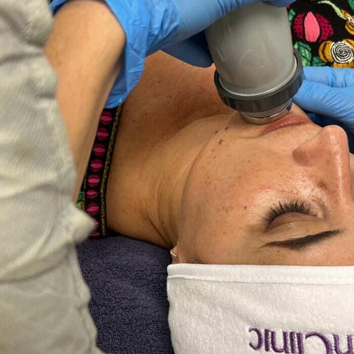 Images Clínica Medicina Estética Sevilla - Artemisa