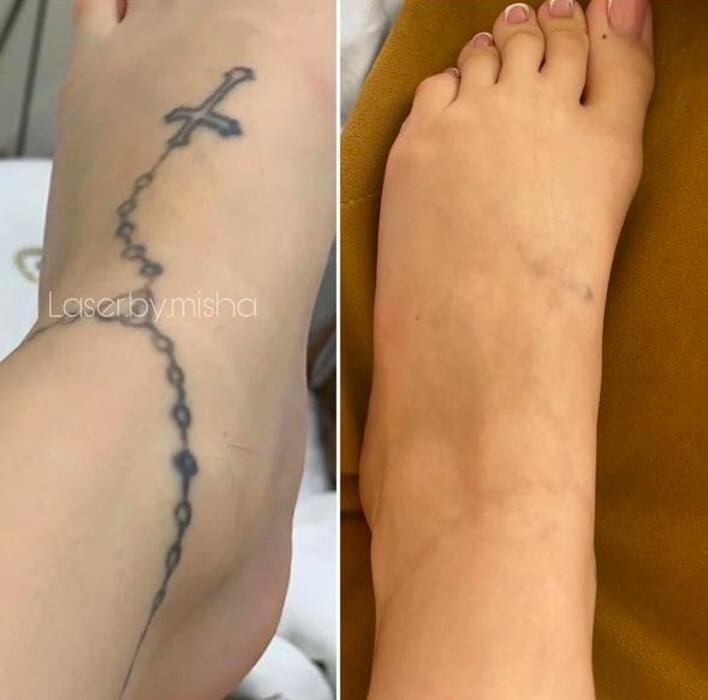 Images Laser by Misha