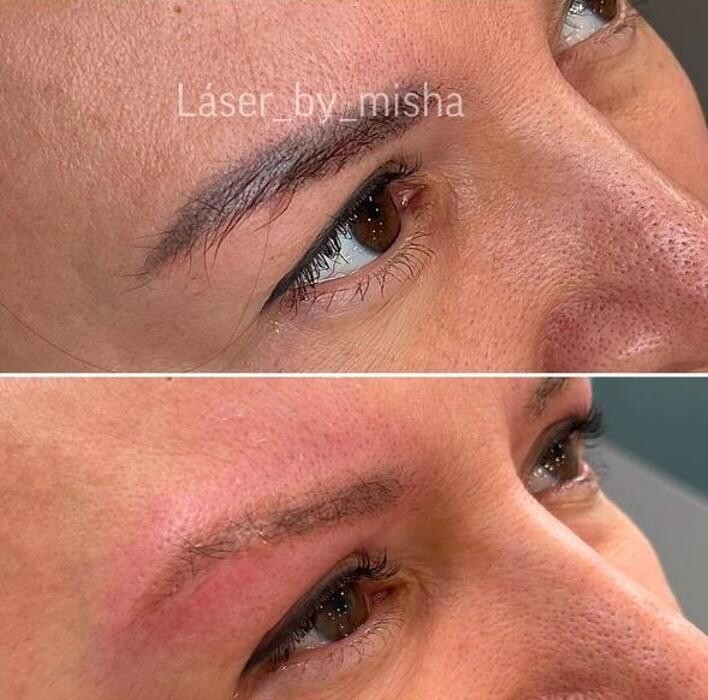 Images Laser by Misha