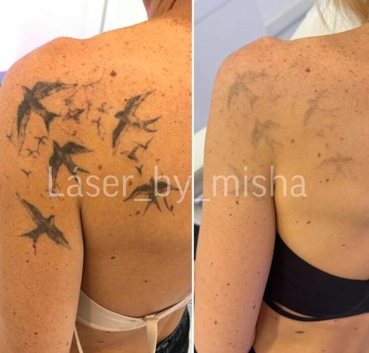 Images Laser by Misha