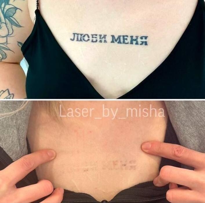 Images Laser by Misha