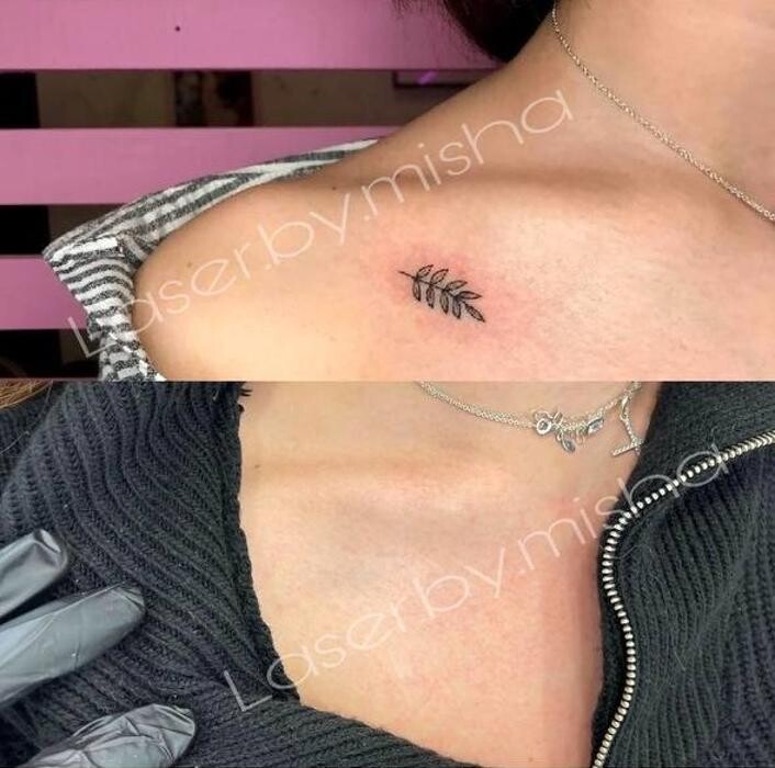 Images Laser by Misha