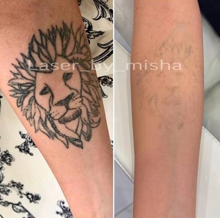 Images Laser by Misha