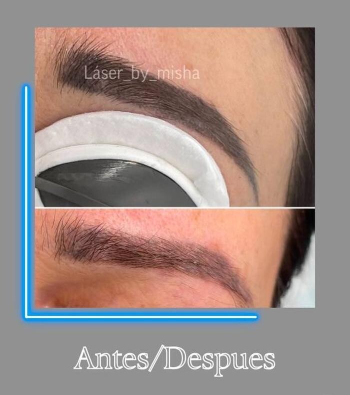 Images Laser by Misha