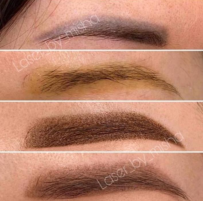 Images Laser by Misha