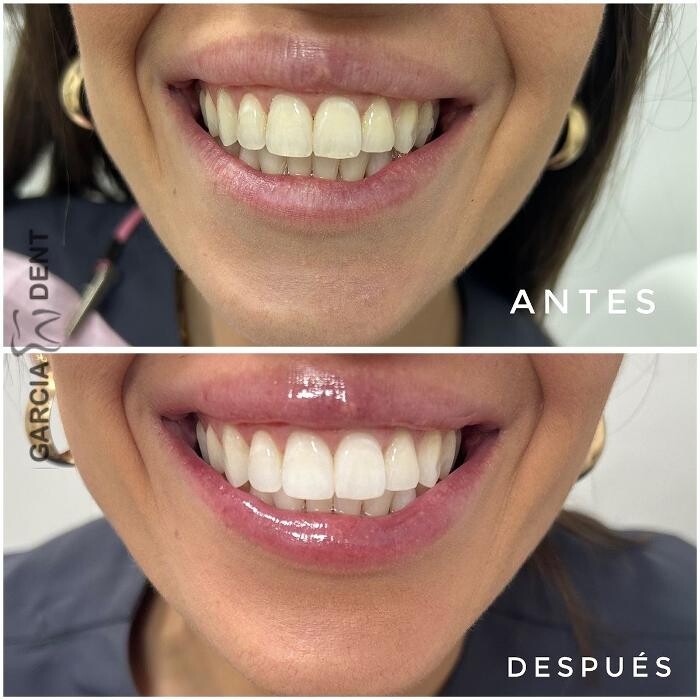 Images GARCÍA DENT CLINIC