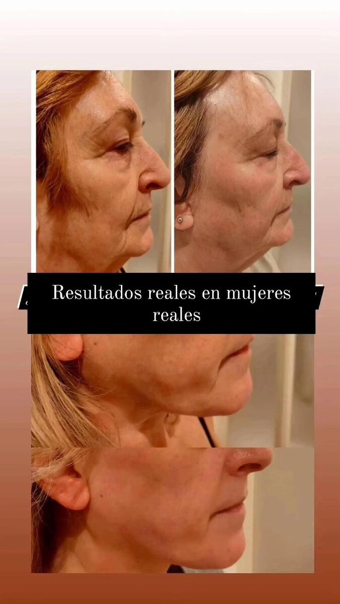 Images Estetic Natura - Centro de Estética Integral Avanzada en Barcelona