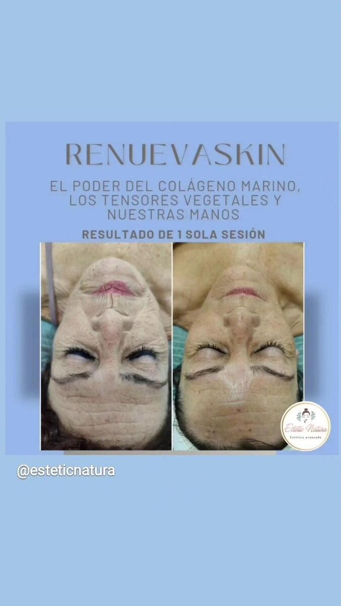 Images Estetic Natura - Centro de Estética Integral Avanzada en Barcelona