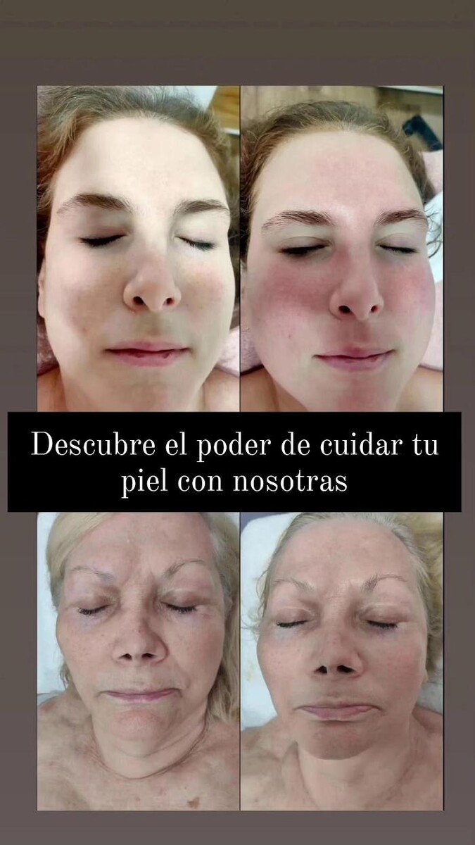 Images Estetic Natura - Centro de Estética Integral Avanzada en Barcelona