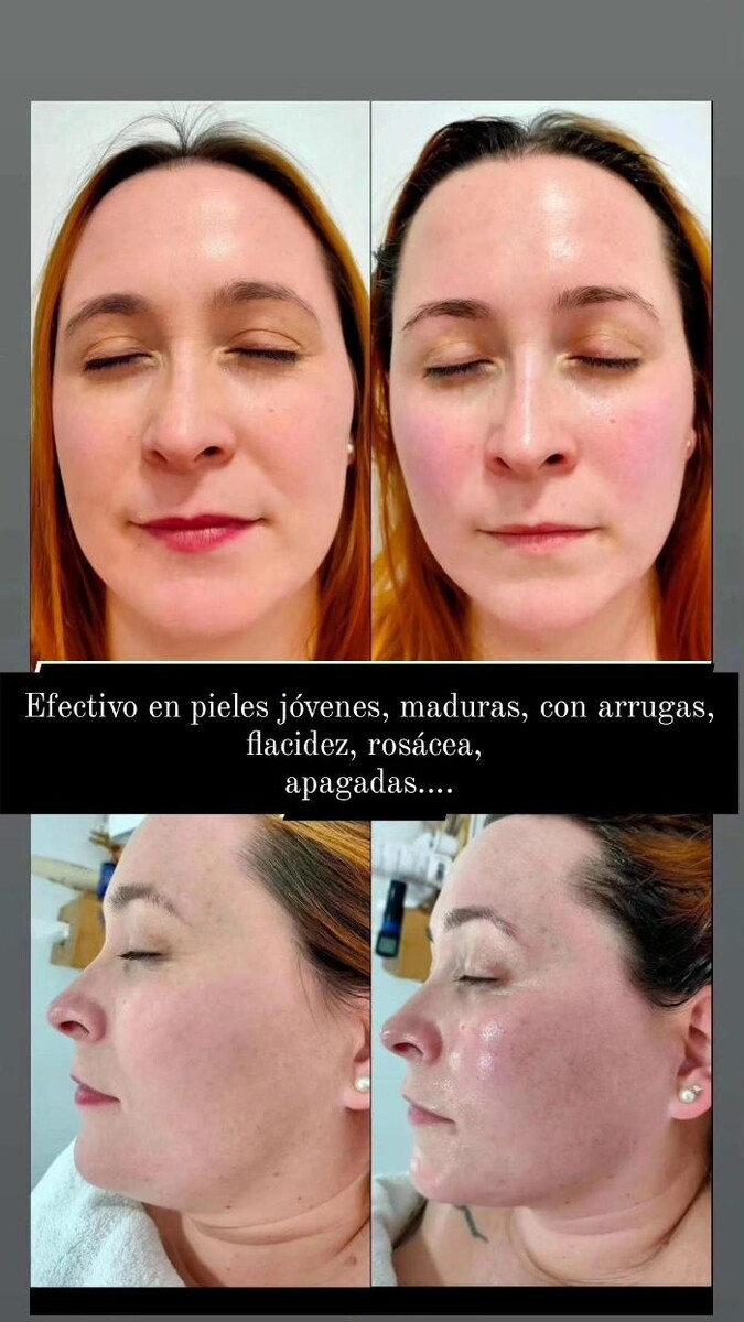 Images Estetic Natura - Centro de Estética Integral Avanzada en Barcelona